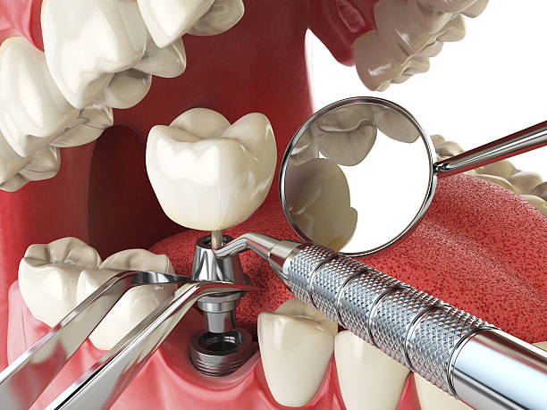 Best Emergency Denture Repair in Weston, NJ